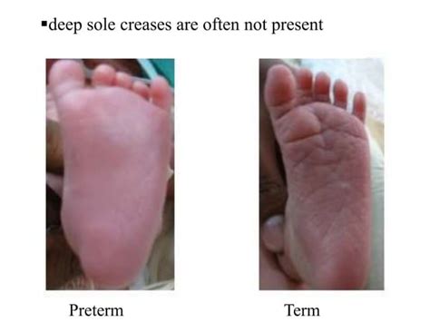 smooth soles without creases.